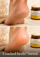 Whipped Tallow Balm for Cracked Heels